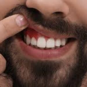 پیشرفت سرطان دهان و چشم انداز