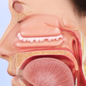 چگونه پولیپ بینی را از بین ببریم؟