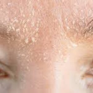 چگونه سد دفاعی پوست خود را بازیابی کنید