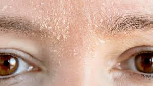 چگونه سد دفاعی پوست خود را بازیابی کنید