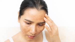 خلاصهای از نقش لایهبرداری