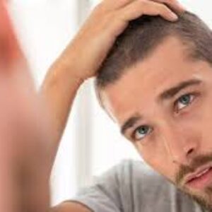 چه زمانی برای ریزش مو به پزشک مراجعه کنیم