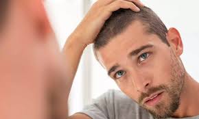چه زمانی برای ریزش مو به پزشک مراجعه کنیم