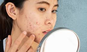 چه بیماریهای پوستی بر سلامت روان تأثیر میگذارند؟